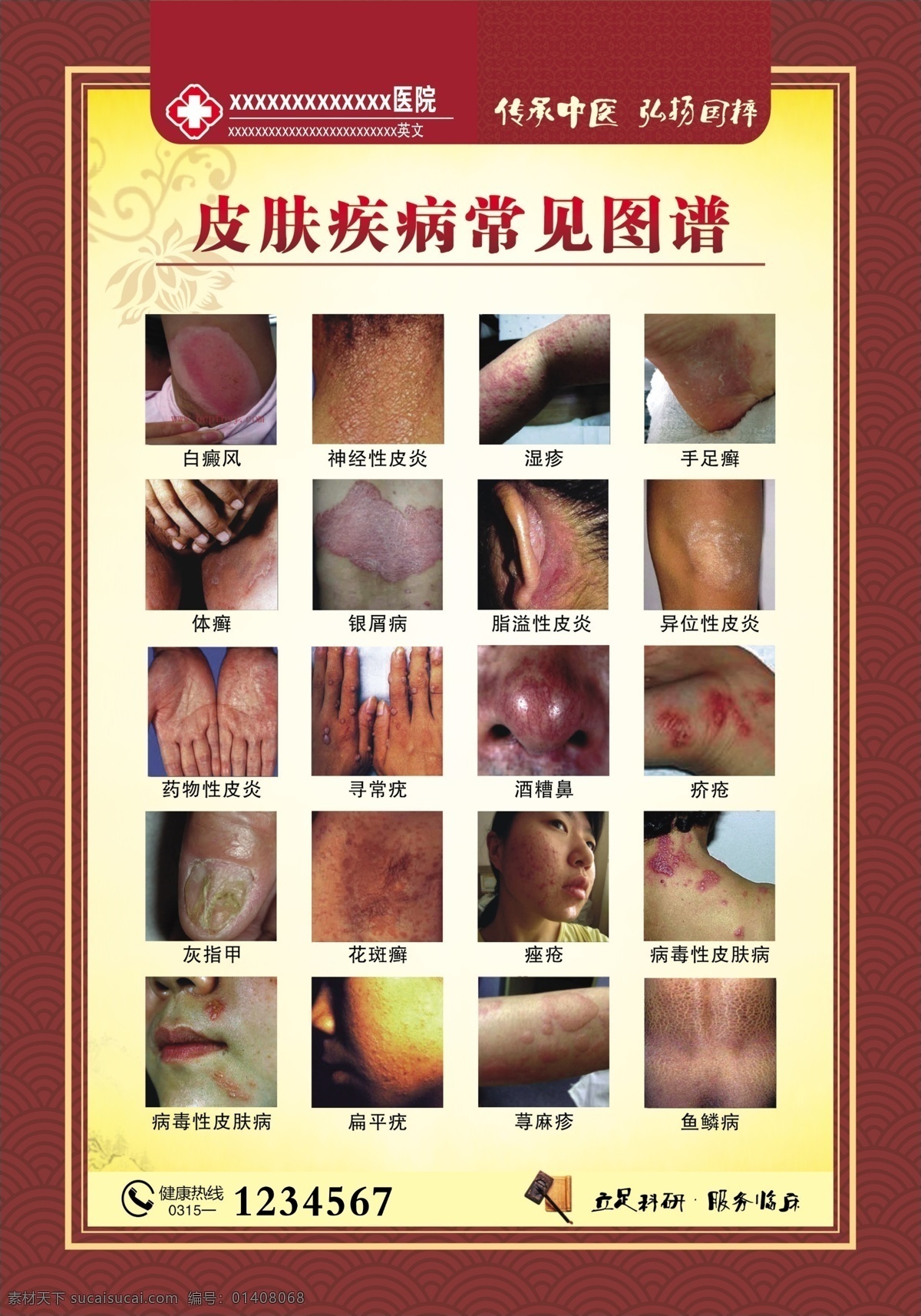 廣告設(shè)計(jì)模板 源文件 展板模板 中醫(yī)院展板 皮膚科展板 皮膚病 疾病 常見 圖譜 皮膚 疾病治療 儀器 簡介 美容 項(xiàng)目 對比 圖 結(jié)構(gòu)圖 功能 光動力治療儀 其他展板設(shè)計(jì)