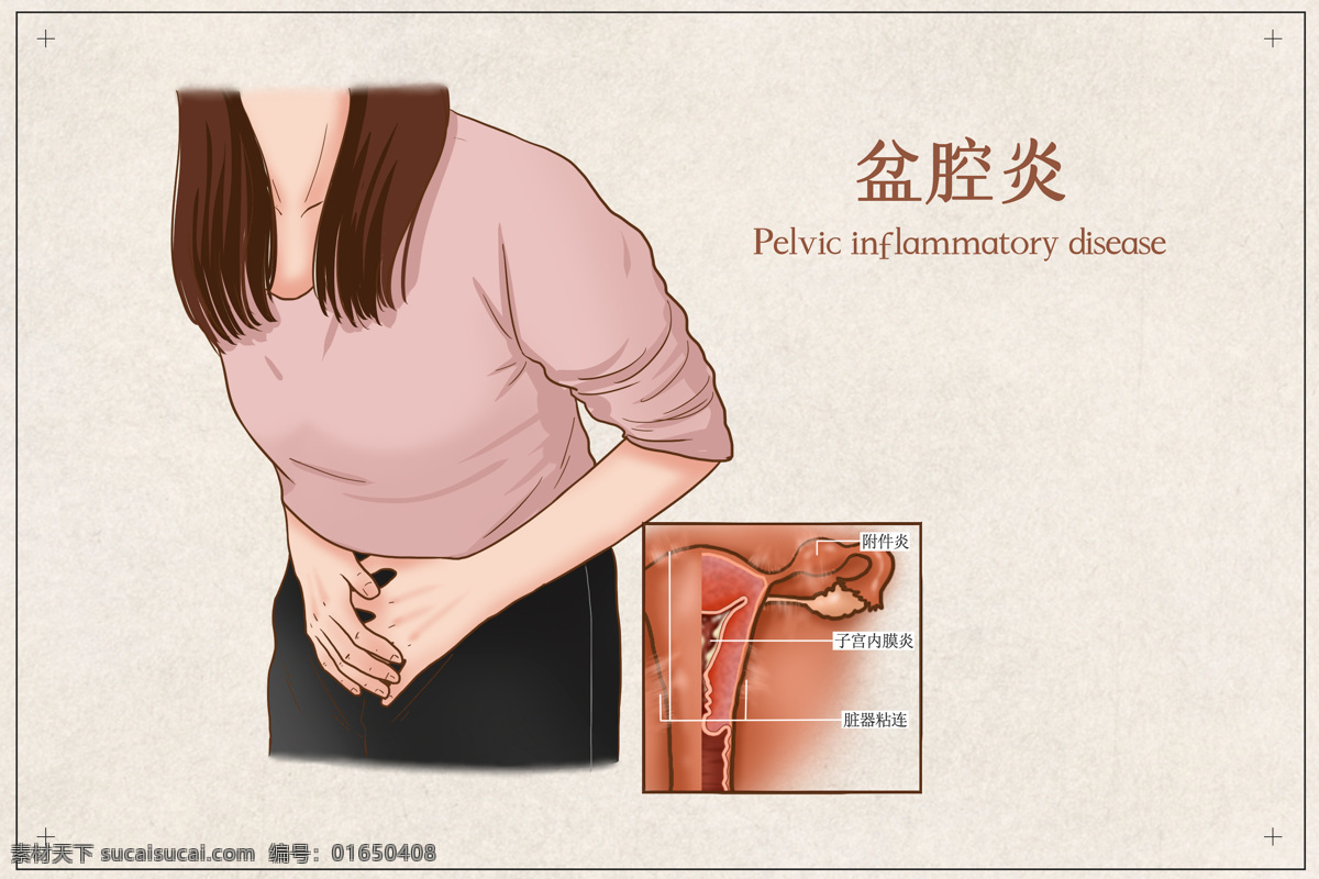 盆腔炎 疾病 健康 卫生 背景 素材图片