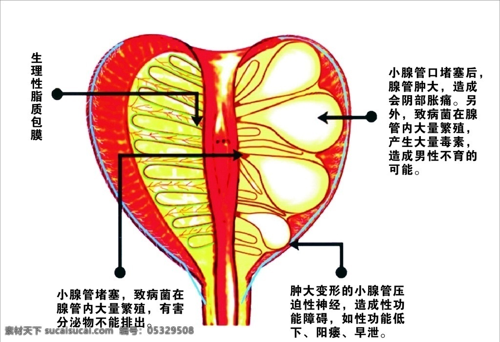 男性 泌尿 生殖 系统 解剖 图 生殖系统 解剖图 男科医院 国内广告设计