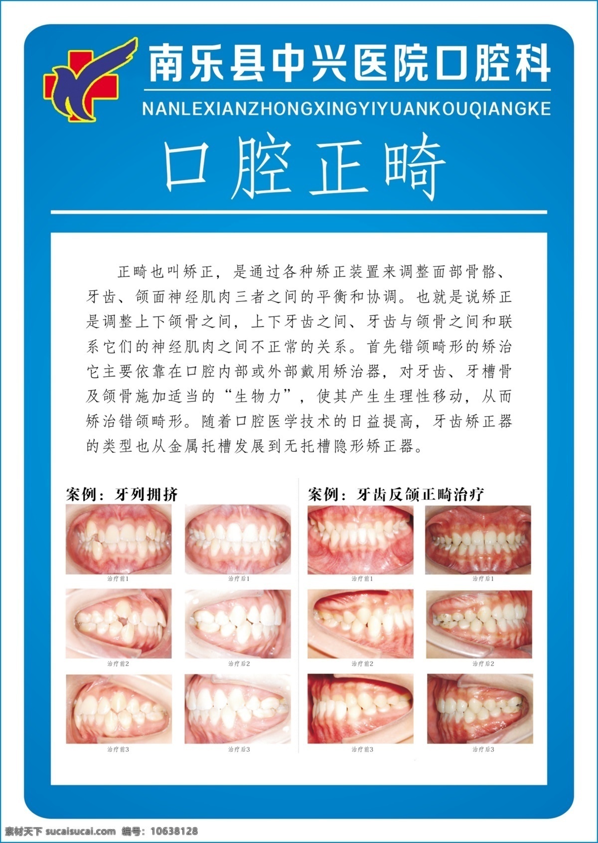牙科口腔 牙科海报 牙科单页 牙科写真 口腔正畸 牙科详细 分层