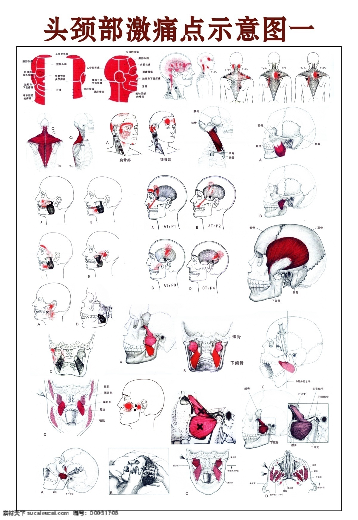 头颈部 激 痛点 示意图 头颈部激痛点 骨架 骨骼 医学骨架 人体构造 人物图库