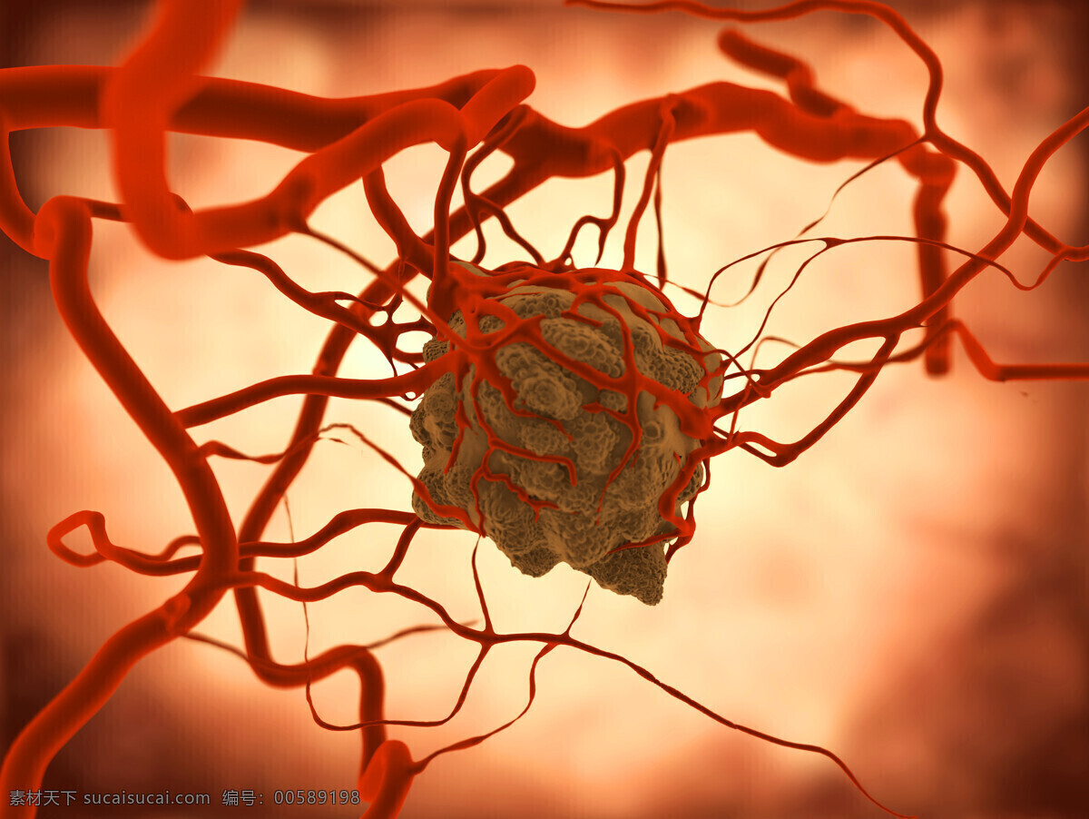 癌变 细胞 生物细胞 癌细胞 癌症 病毒 细胞图片 现代科技