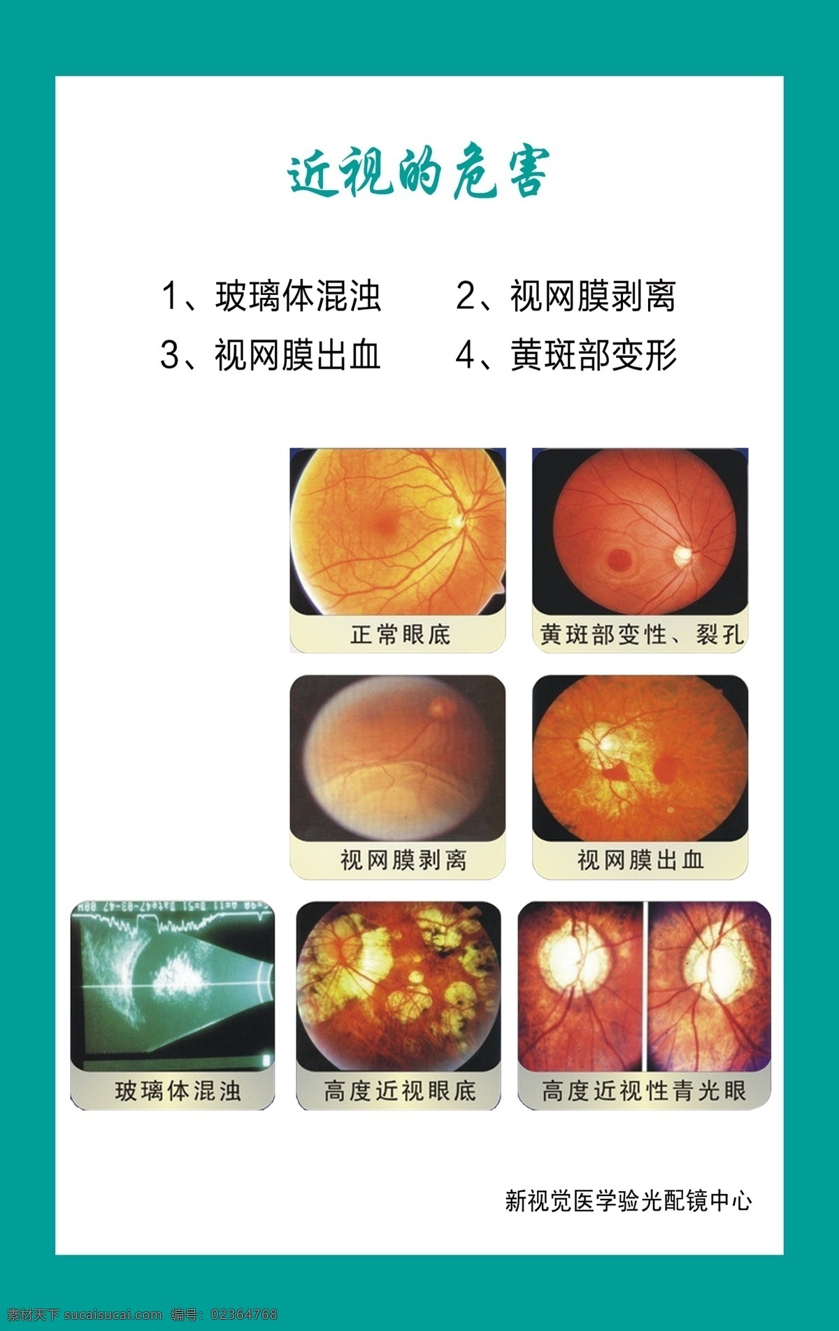 眼科 近视的危害 眼镜 蓝色 近视