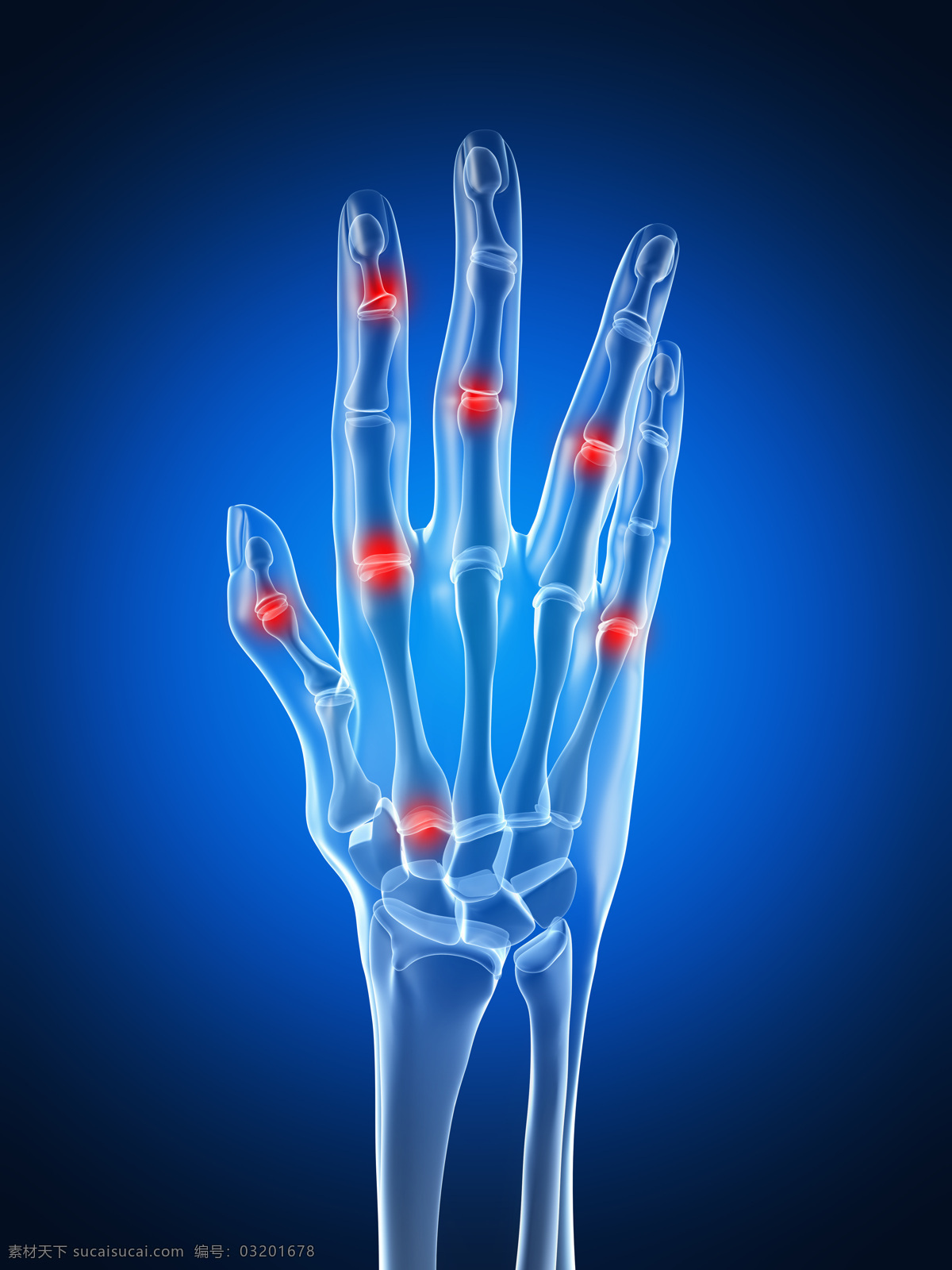 手指 关节 疼痛 手指关节疼痛 手指关节 关节疼 关节痛 关节炎 人体关节 骨骼 人体器官图 医疗护理 现代科技