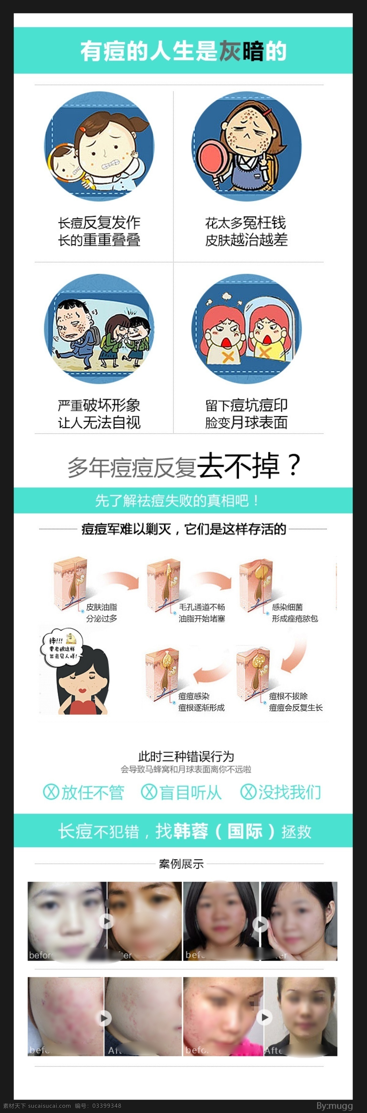 青春痘 去青春痘 美容 祛痘广告 韩蓉