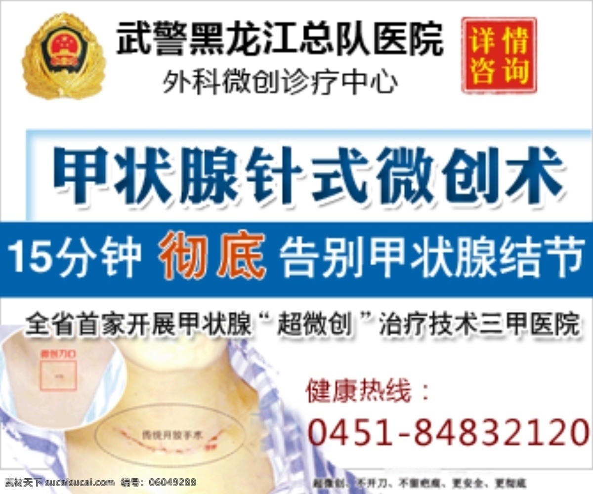 新闻 源 广告 小 图 新闻源 黑龙江医院 小图弹窗 原创设计 原创网页设计