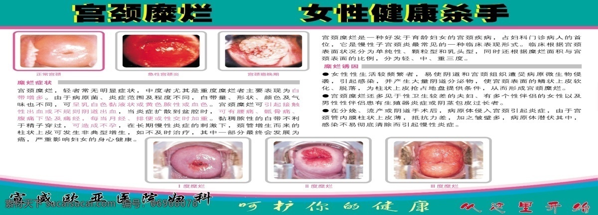 医院 分层 妇科 女性生殖器 源文件 psd源文件