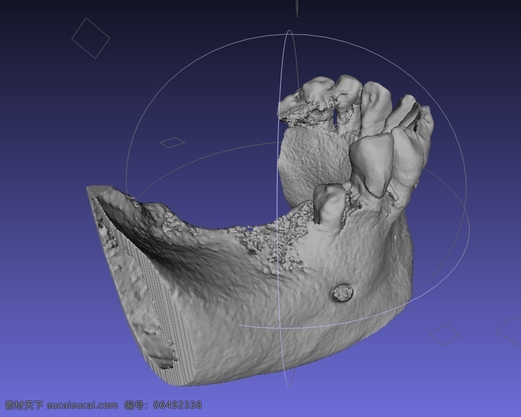 下颌骨 dicom 牙科 医疗 stl 3d模型素材 其他3d模型