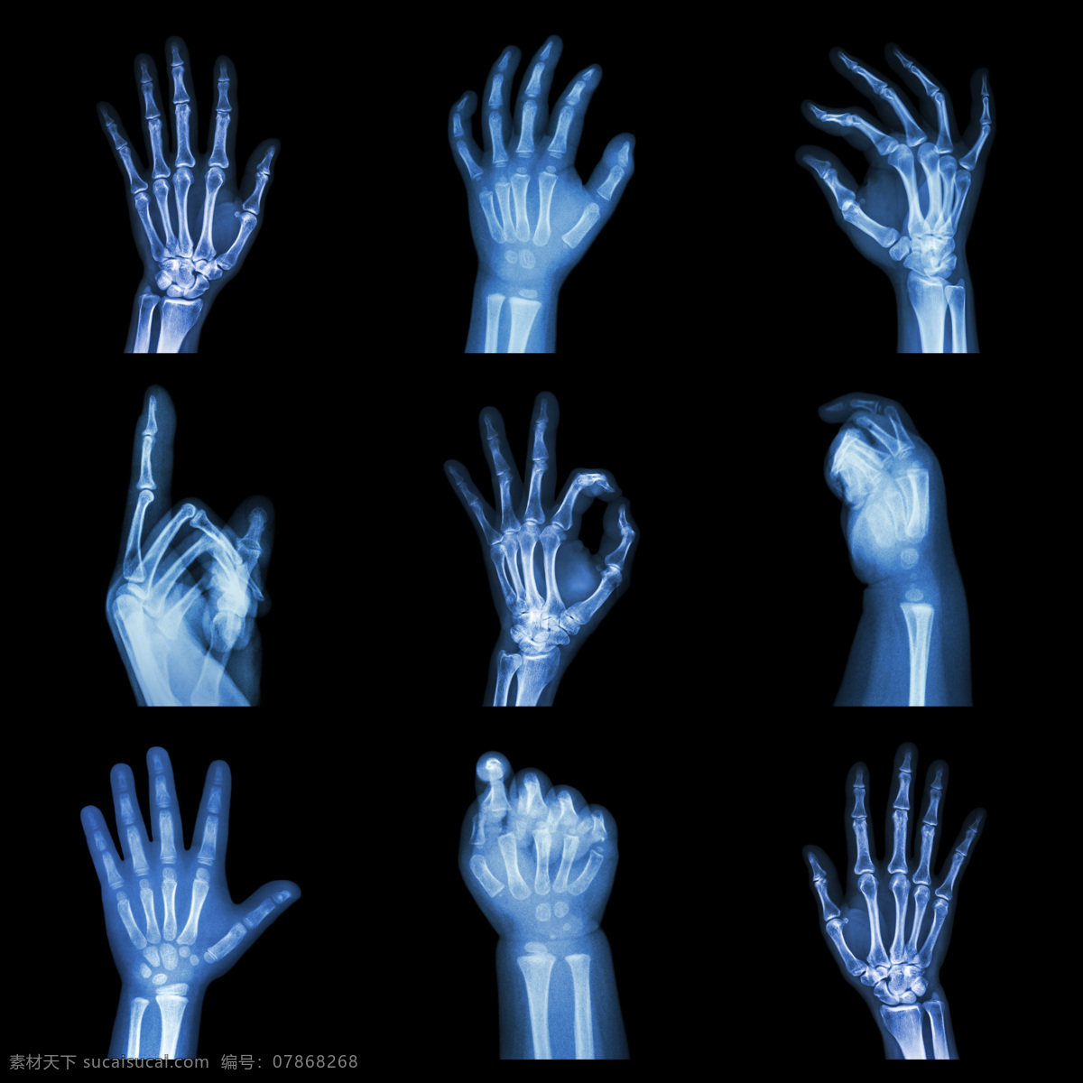 手 x 光 片 医疗护理 医学研究 x光片 x光片图片 医疗 拍片 医学研究素材 护理 图片库 现代科技