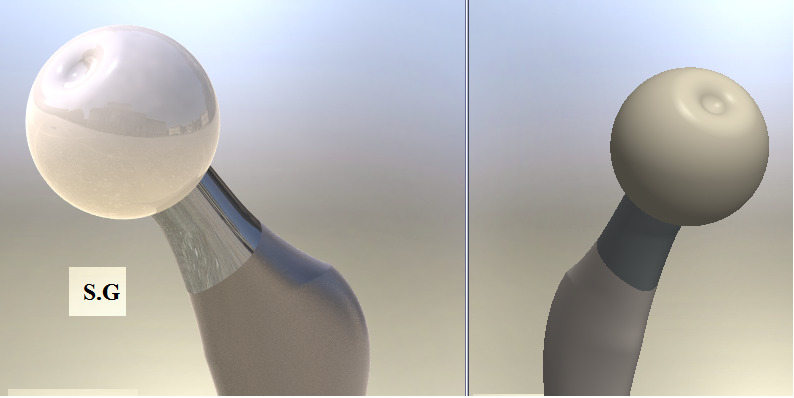 股骨 假体 3d 教育 医疗 3d模型素材 3d打印模型