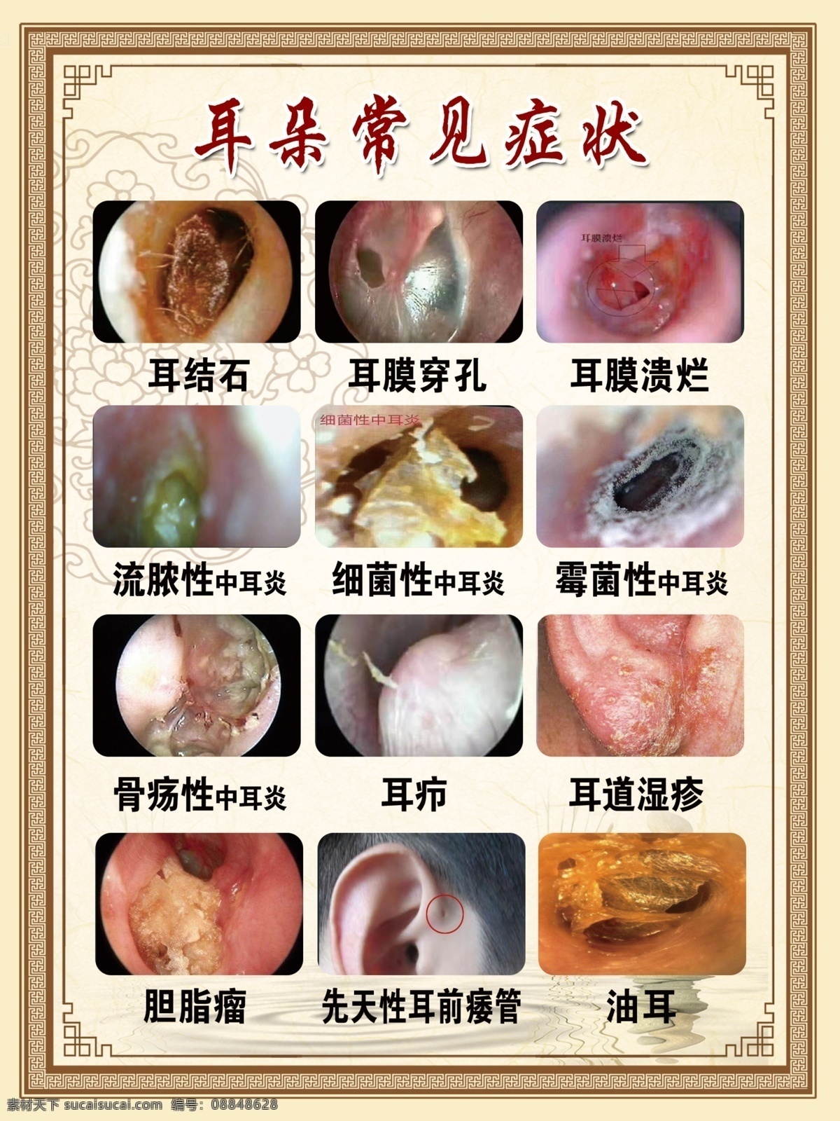 耳朵常见症状 采耳 中耳炎 症状 常见症状 耳结石 耳朵 采耳店 耳道湿疹 专业 养生馆 中医