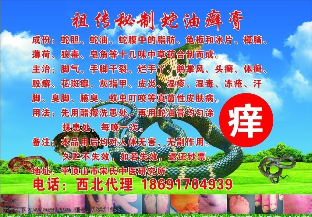 蛇油 癣膏 体癣 牛皮癣 头癣 矢量