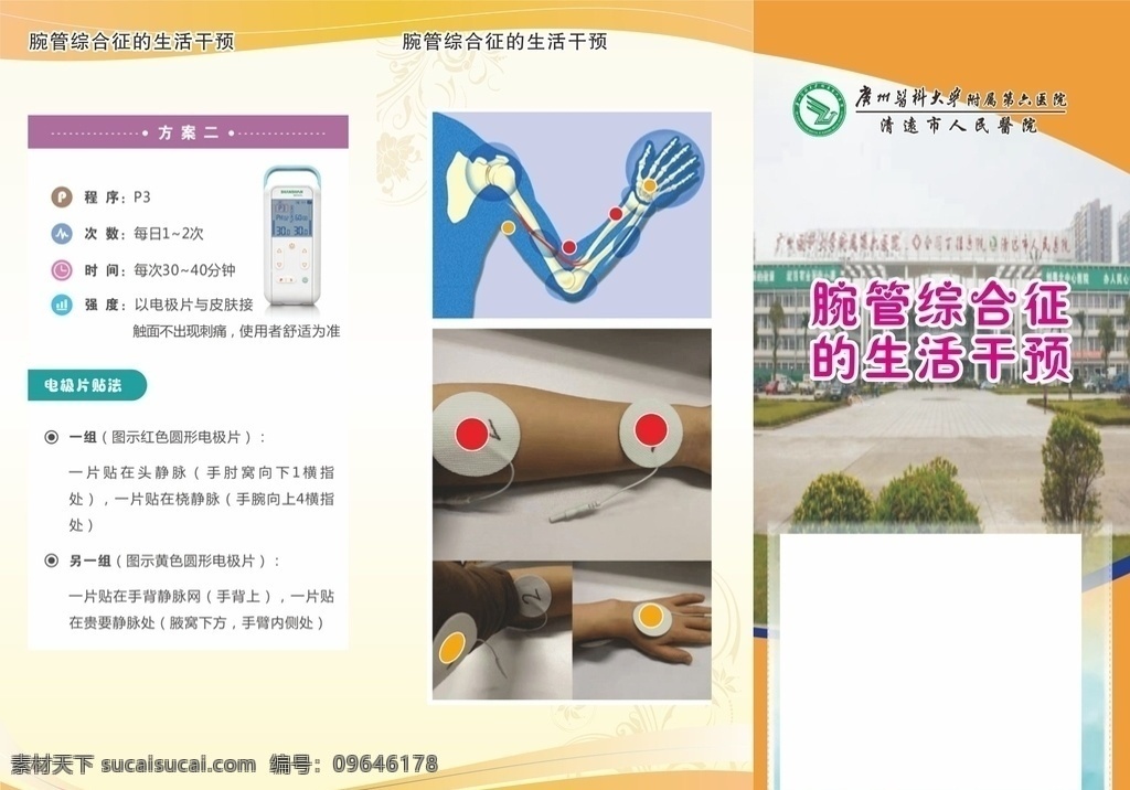腕 综合征 生 三折页 小册子 宣传单张 医院 妇科 dm宣传单