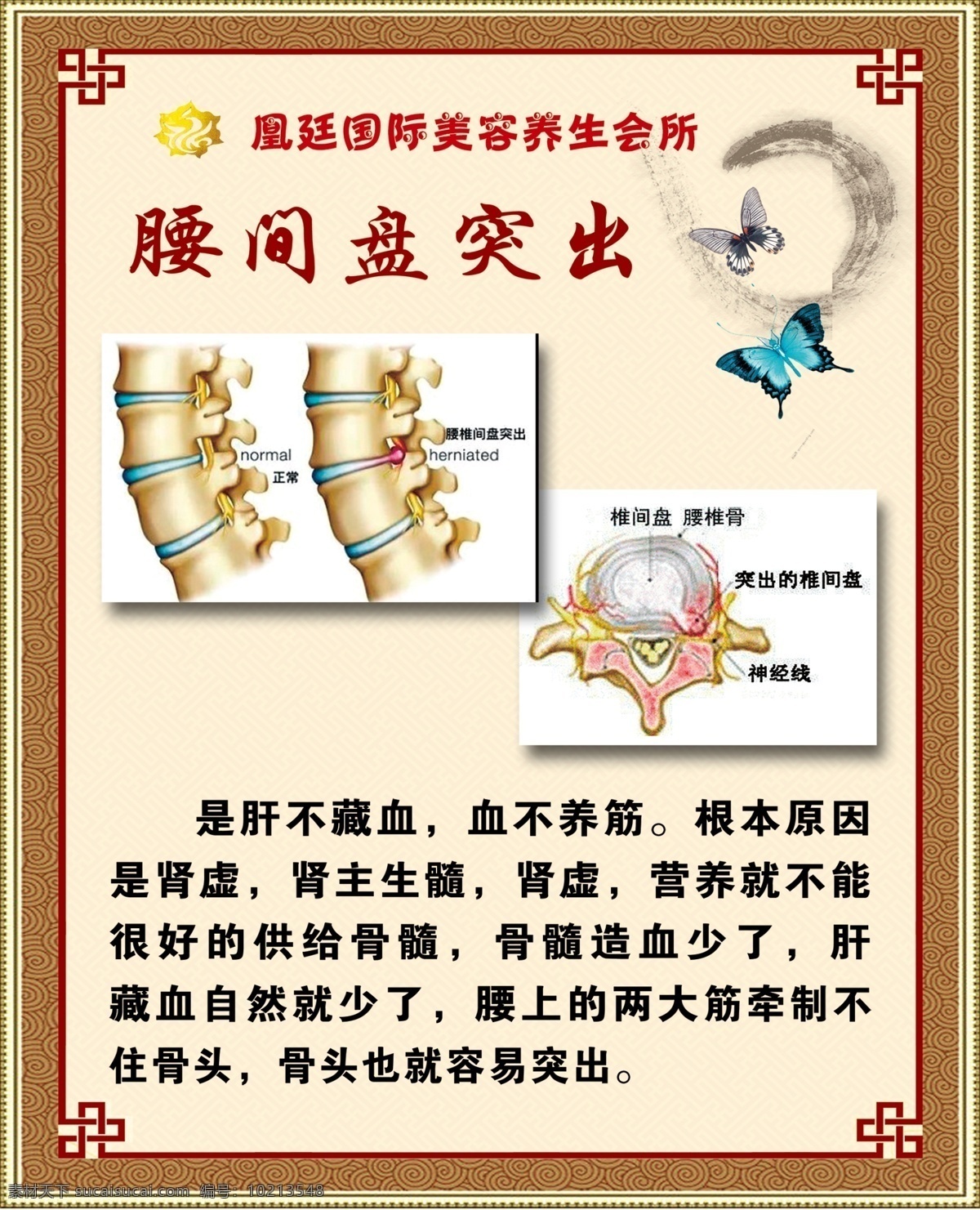 腰间盘突出 养生 广告 展板 海报 健康
