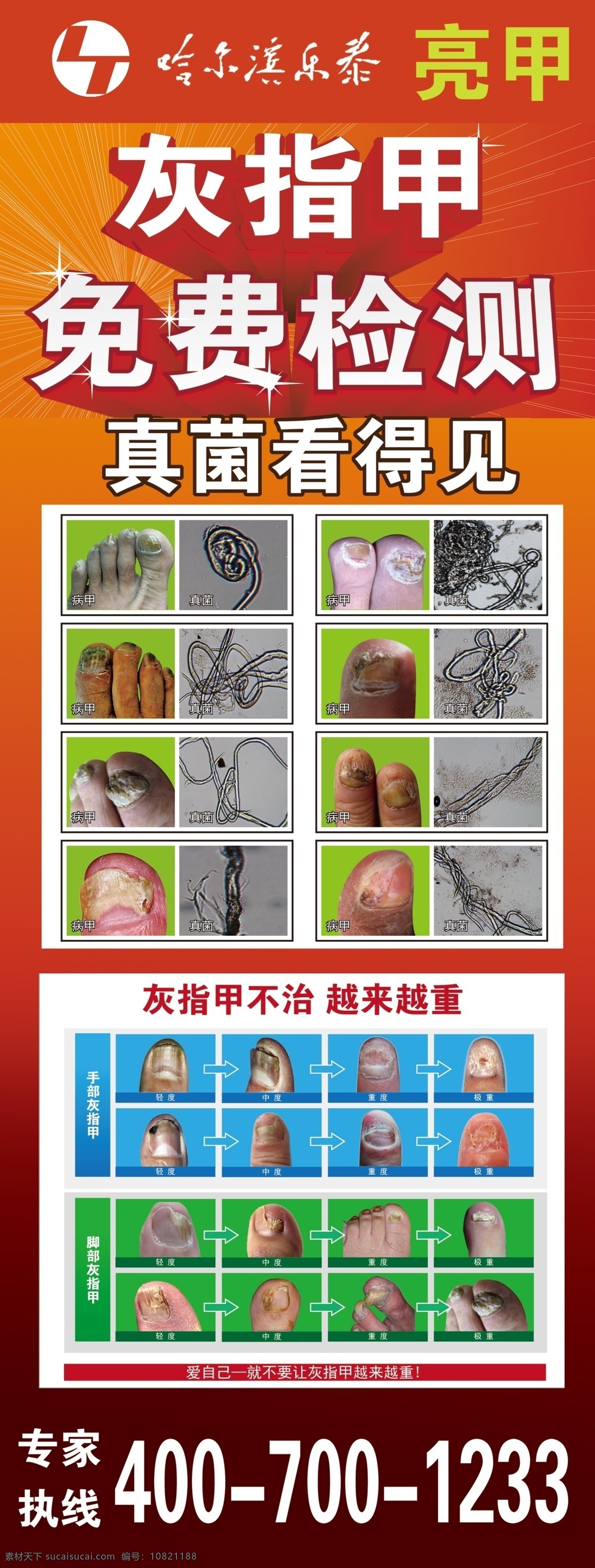 灰指甲海报 灰指甲 图 图案 树状 菌丝 螺旋 葡萄菌丝 关节 团状 平行 单根 广告设计模板 源文件