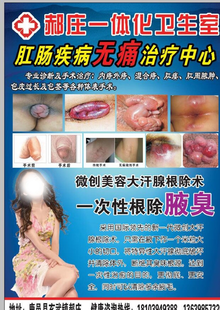 痔疮彩页 痔疮海报 腋臭海报 腋臭彩页 肛肠疾病 肛肠彩页 痔疮 肛肠 腋臭