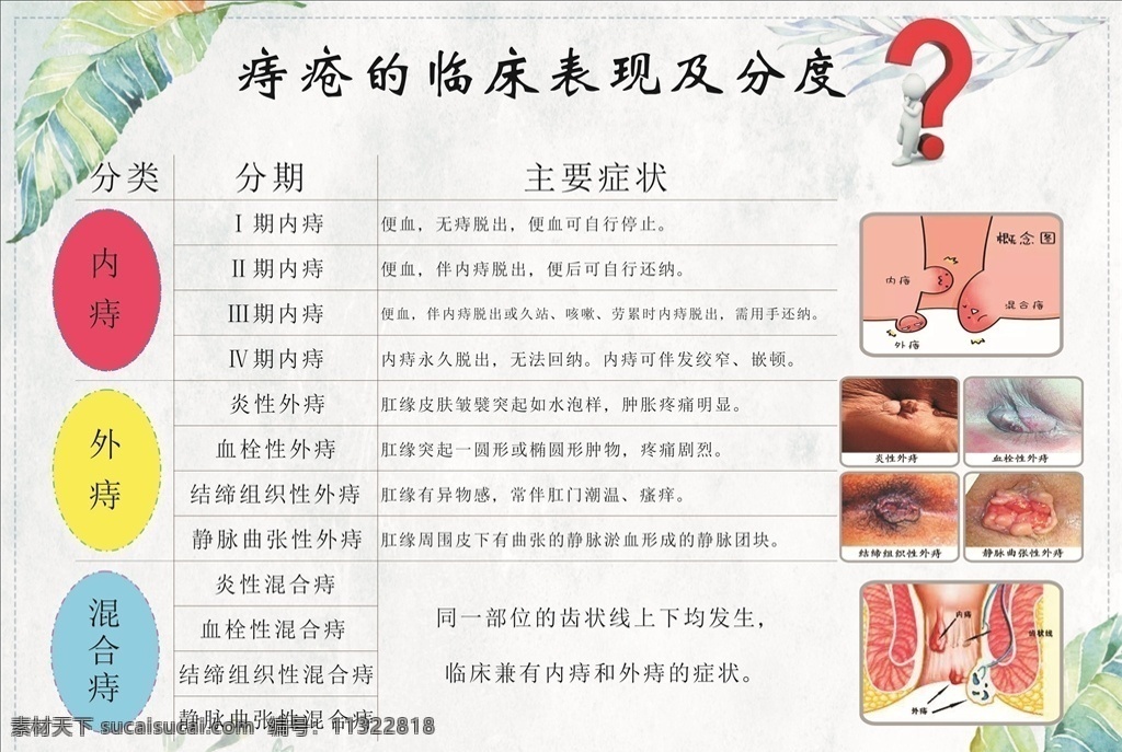 痔疮的临床表现素材图片下载-素材编号11322818-素材天下图库