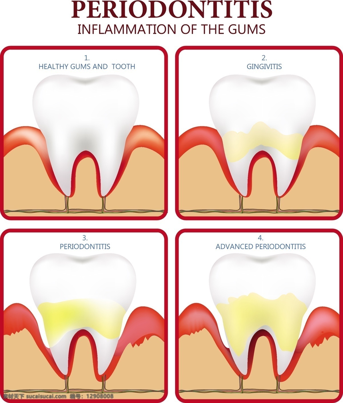 牙周病 海报 平面 彩色 齿 图标 免费 矢量 牙齿 牙疼 护理 牙齿保护 牙医 矢量背景 牙齿结构