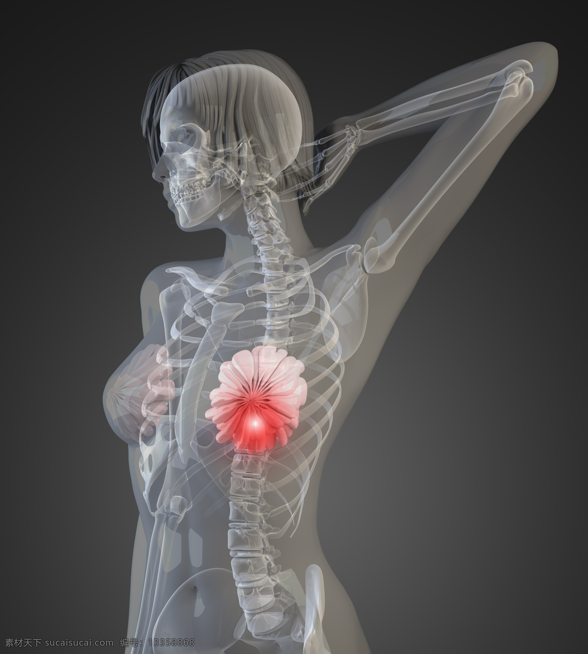 女性 胸部 x 光 透视图 医疗主题 人体 x光 图像 医疗护理 现代科技