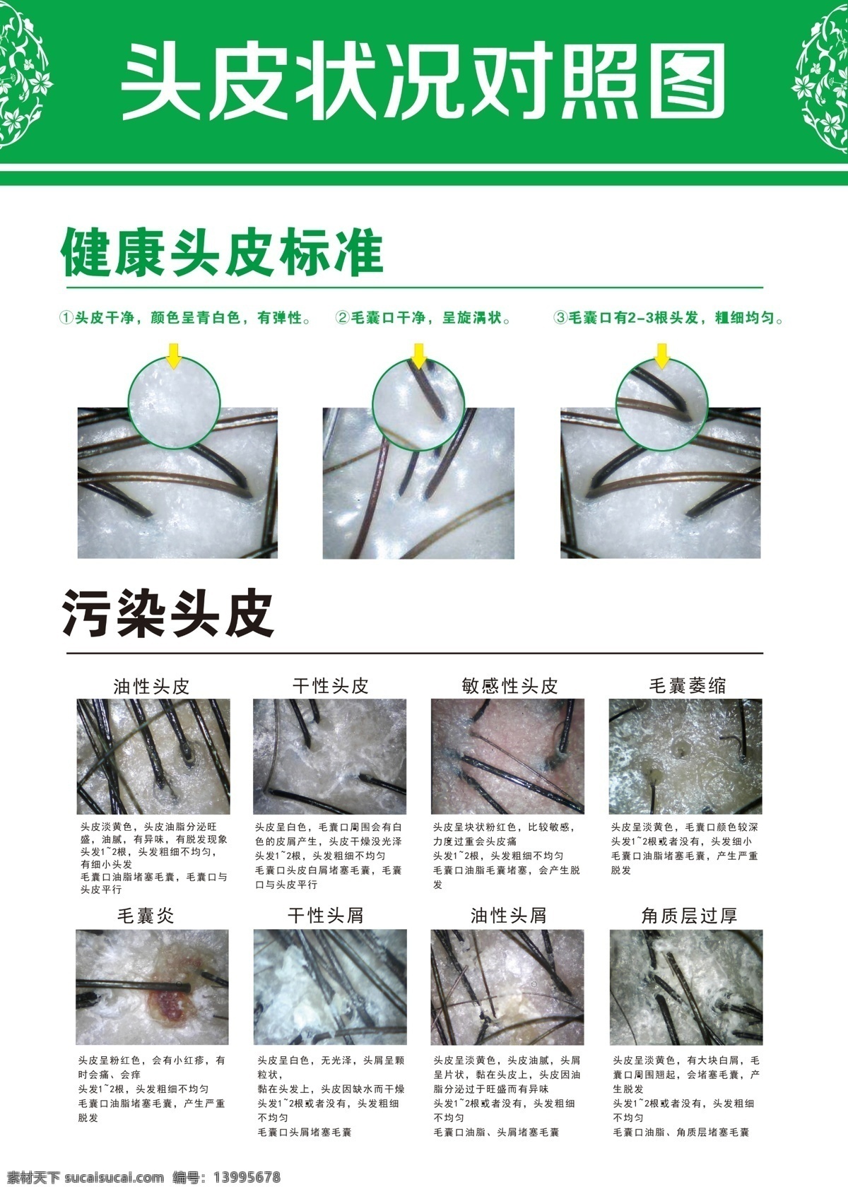 头皮 状况 对照表 头皮状况对照 健康头发标准 污染头发 洗发水展板 头皮对照 头发 毛囊炎 头发对照 展板模板
